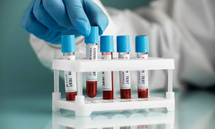 Qué estudiar para ser epidemiólogo: guía completa